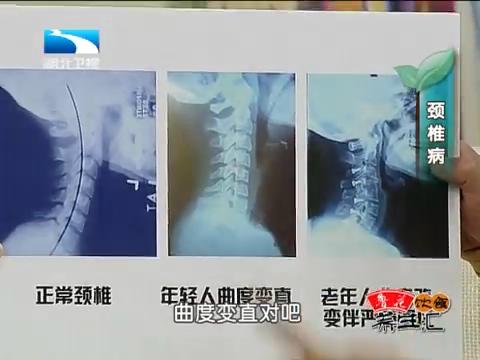 湖北卫视养生汇罗炳翔保护颈椎