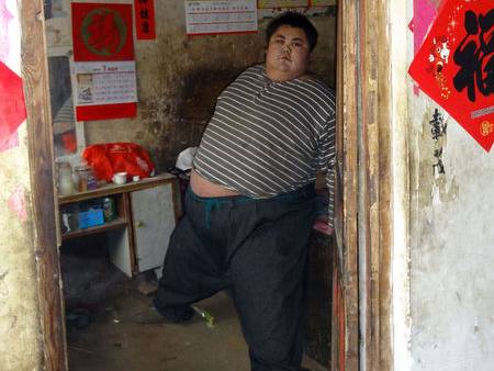 中国第一胖孙亮600斤22岁心衰去世
