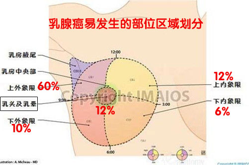 原创:33岁姚贝娜乳腺癌病逝深度分析