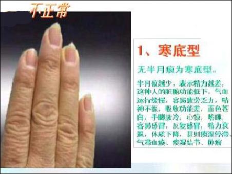 再议手指半月痕与健康的关系-别有病Byb.cn-纯